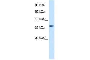 WB Suggested Anti-DLX6 Antibody Titration: 0. (DLX6 Antikörper  (Middle Region))