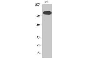 Western Blotting (WB) image for anti-Insulin Receptor Substrate 1 (IRS1) (Ser62) antibody (ABIN3175713) (IRS1 Antikörper  (Ser62))
