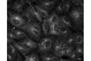 Immunofluorescent staining of A549 (ATCC CCL-185) cells. (pi 4-Kinase, beta (AA 411-626) Antikörper)