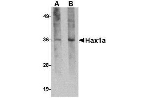 Image no. 1 for anti-HCLS1 Associated Protein X-1 (HAX1) (N-Term) antibody (ABIN341762) (HAX1 Antikörper  (N-Term))