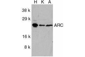 Western blot analysis of ARC in HeLa (H), KB (K), and A549 (A) whole cell lysates with ARC antibody at 1ug/ml. (NOL3 Antikörper  (C-Term))