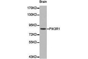 Western Blotting (WB) image for anti-Phosphoinositide 3 Kinase, p85 alpha (PI3K p85a) antibody (ABIN1874135) (PIK3R1 Antikörper)