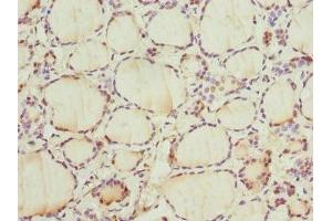 Immunohistochemistry of paraffin-embedded human thyroid tissue using ABIN7153399 at dilution of 1:100 (Cyclin E2 Antikörper  (AA 255-404))