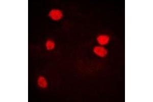 Immunofluorescent analysis of LSm4 staining in U2OS cells. (LSM4 Antikörper)