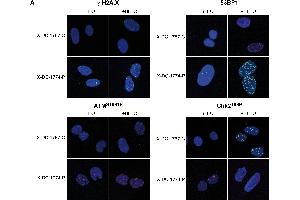 Immunofluorescence (Cultured Cells) (IF (cc)) image for anti-Ataxia Telangiectasia Mutated (ATM) (AA 1974-1988), (pSer1981) antibody (ABIN6656104)