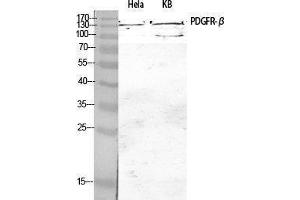 Western Blotting (WB) image for anti-Platelet Derived Growth Factor Receptor beta (PDGFRB) (Thr215) antibody (ABIN3180254) (PDGFRB Antikörper  (Thr215))