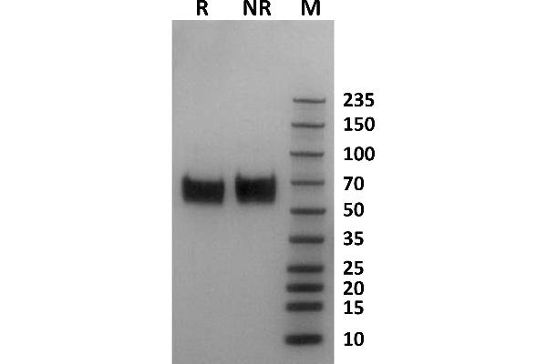 FCGR1A Protein (AA 16-281) (His-Avi Tag)