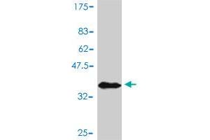 Western Blot detection against Immunogen (37. (AKT1 Antikörper  (AA 381-480))