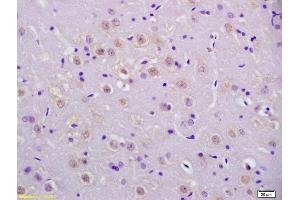 Formalin-fixed and paraffin embedded rat brain labeled with Anti-phospho-P53(Ser20) Polyclonal Antibody, Unconjugated (ABIN702895) at 1:200 followed by conjugation to the secondary antibody and DAB staining. (p53 Antikörper  (pSer20))