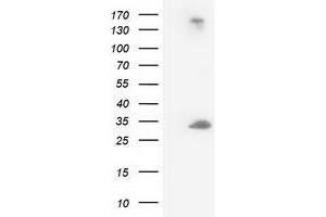 HEK293T cells were transfected with the pCMV6-ENTRY control (Left lane) or pCMV6-ENTRY DCK (Right lane) cDNA for 48 hrs and lysed. (DCK Antikörper)