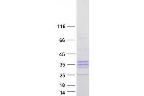 PRSS55 Protein (Transcript Variant 2) (Myc-DYKDDDDK Tag)