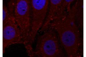 Immunofluorescence staining of methanol-fixed Hela cells, using Phospho-SNCA-Y133 antibody. (SNCA Antikörper  (pTyr133))