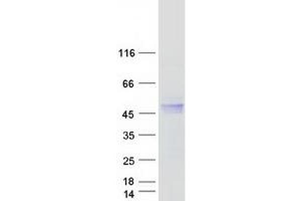 HFE Protein (Transcript Variant 1) (Myc-DYKDDDDK Tag)