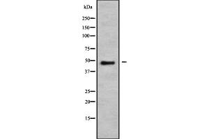 Western blot analysis NMUR1 using K562 whole cell lysates. (NMUR1 Antikörper)