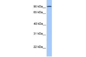 WB Suggested Anti-CDH16 Antibody Titration:  0. (Cadherin-16 Antikörper  (N-Term))