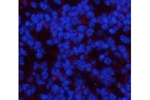 Immunofluorescence analysis of Mouse spleen tissue using PDGFRA Monoclonal Antibody at dilution of 1:200. (PDGFRA Antikörper)