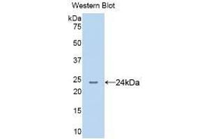 Detection of Recombinant AGR2, Human using Monoclonal Antibody to Anterior Gradient 2 (AGR2) (AGR2 Antikörper  (AA 21-175))