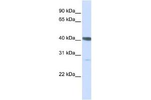 DNAJB11 antibody used at 1 ug/ml to detect target protein. (DNAJB11 Antikörper)