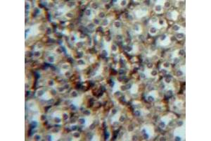 Used in DAB staining on fromalin fixed paraffin-embedded Kidney tissue (p53 Antikörper  (AA 108-370))