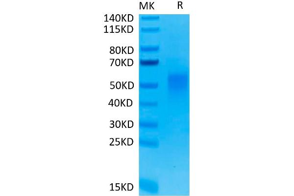 CD28 Protein (CD28) (His-Avi Tag,Biotin)