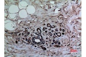 Immunohistochemistry (IHC) analysis of paraffin-embedded Human Breast, antibody was diluted at 1:100. (Histone 3 Antikörper  (meLys37))
