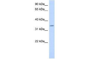 PAQR6 antibody used at 1 ug/ml to detect target protein. (PAQR6 Antikörper  (Middle Region))