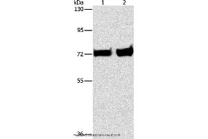 Western blot analysis of Mouse liver and kidney tissue, using PCK1 Polyclonal Antibody at dilution of 1:375 (PCK1 Antikörper)