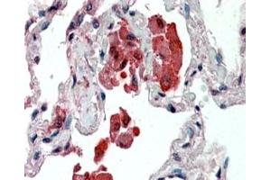 IHC staining of FFPE human lung with IDE antibody at 2. (IDE Antikörper)