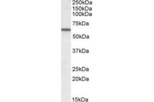 Western Blotting (WB) image for anti-Vitamin D-Binding Protein (GC) (Internal Region) antibody (ABIN2464266) (Vitamin D-Binding Protein Antikörper  (Internal Region))