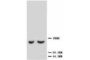 Image no. 1 for anti-Metalloproteinase Inhibitor 2 (TIMP2) (C-Term) antibody (ABIN1493035) (TIMP2 Antikörper  (C-Term))