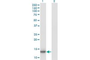 Western Blot analysis of IL2 expression in transfected 293T cell line by IL2 monoclonal antibody (M11), clone 1C5. (IL-2 Antikörper  (AA 21-153))