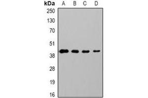 Western blot analysis of GAP43 expression in Hela (A), 293T (B), mouse brain (C), rat brain (D) whole cell lysates. (GAP43 Antikörper)