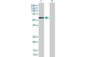 Western Blot analysis of ATP6V1B2 expression in transfected 293T cell line by ATP6V1B2 MaxPab polyclonal antibody. (ATP6V1B2 Antikörper  (AA 1-511))