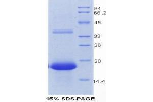 SDS-PAGE analysis of Mouse REG3G Protein. (REG3g Protein)