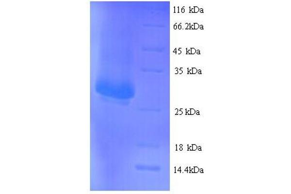 Integrin Alpha2b Protein (CD41) (AA 639-887) (His tag)