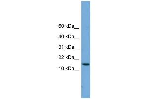 WB Suggested Anti-PAGE4 Antibody Titration:  0. (PAGE4 Antikörper  (Middle Region))