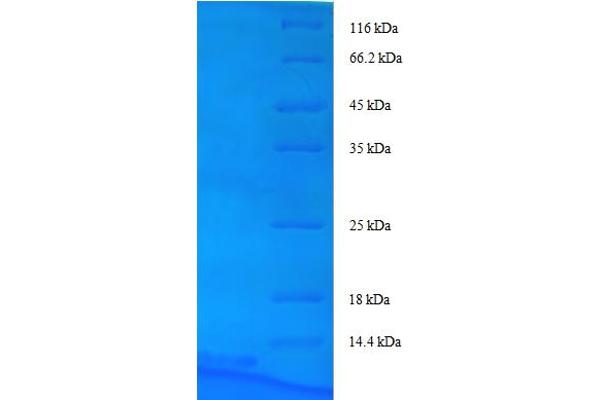 ATP-Binding Cassette, Sub-Family B (MDR/TAP), Member 1B (ABCB1B) (AA 236-297), (partial) protein (His tag)