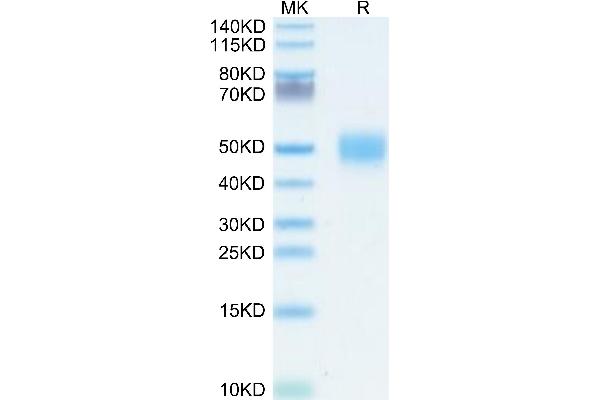 VSIG1 Protein (AA 22-232) (His tag)