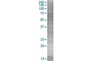 TNFRSF1B transfected lysate. (TNFRSF1B 293T Cell Transient Overexpression Lysate(Denatured))