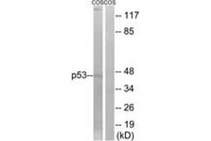 Western Blotting (WB) image for anti-Tumor Protein P53 (TP53) (AA 8-57) antibody (ABIN2889048) (p53 Antikörper  (AA 8-57))