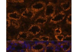 Immunofluorescence analysis of Rat kidney using SLC7A9 Polyclonal Antibody at dilution of 1:100. (SLC7A9 Antikörper)