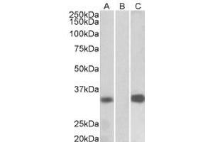 Western Blotting (WB) image for anti-Kv Channel Interacting Protein 3, Calsenilin (KCNIP3) (Internal Region) antibody (ABIN2465100) (DREAM Antikörper  (Internal Region))
