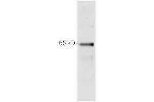 Western Blotting (WB) image for anti-Nuclear Factor-kB p65 (NFkBP65) (C-Term) antibody (ABIN964680)