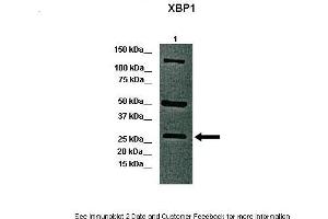 Lanes:   Lane 1: 40ug whole canine retina  Primary Antibody Dilution:   1:1000  Secondary Antibody:   Anti-rabbit-HRP  Secondary Antibody Dilution:   1:5000  Gene Name:   XBP1 a  Submitted by:   Dr. (XBP1 Antikörper  (C-Term))