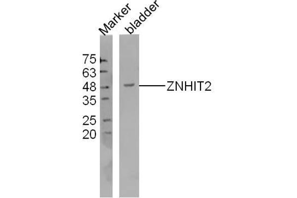ZNHIT2 Antikörper  (AA 51-150)