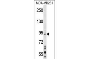 D1L1 Antibody (N-term) (ABIN656281 and ABIN2845591) western blot analysis in MDA-M cell line lysates (35 μg/lane). (MAD1L1 Antikörper  (N-Term))