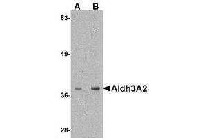 Image no. 1 for anti-Aldehyde Dehydrogenase 3 Family, Member A2 (ALDH3A2) (C-Term) antibody (ABIN342713) (ALDH3A2 Antikörper  (C-Term))