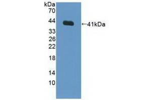 Detection of Recombinant FNTa, Human using Polyclonal Antibody to Farnesyltransferase Alpha (FNTa) (FNTA Antikörper  (AA 51-366))
