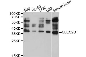 Western blot analysis of extracts of various cell lines, using CLEC2D antibody (ABIN5997460) at 1/1000 dilution. (CLEC2D Antikörper)
