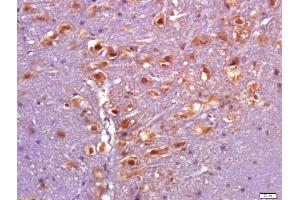 Formalin-fixed and paraffin embedded rat brain labeled with Anti-phospho-PARK2(Ser101) Polyclonal Antibody, Unconjugated (ABIN711251) at 1:200 followed by conjugation to the secondary antibody and DAB staining (Parkin Antikörper  (pSer101))